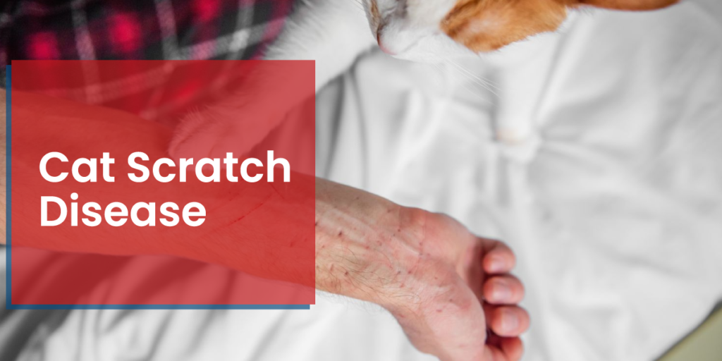 Cat Scratch Disease: Everything You Must Know