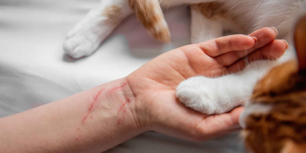 Do You Need a Tetanus Shot for a Cat Scratch?